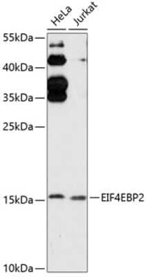 Western Blot: eIF4EBP2 Antibody [NBP3-05131] - Analysis of extracts of various cell lines, using eIF4EBP2 antibody at 1:3000 dilution. Secondary antibody: HRP Goat Anti-Rabbit IgG (H+L) at 1:10000 dilution. Lysates/proteins: 25ug per lane. Blocking buffer: 3% nonfat dry milk in TBST. Detection: ECL Basic Kit