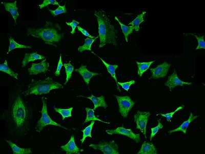 Immunocytochemistry/Immunofluorescence: eIF4H Antibody [NBP2-99470] - Immunofluorescence staining of eIF4H in HeLa cells. Cells were fixed with 4% PFA, permeabilzed with 0.1% Triton X-100 in PBS, blocked with 10% serum, and incubated with rabbit anti-human eIF4H polyclonal antibody (dilution ratio 1:1000) at 4C overnight. Then cells were stained with the Alexa Fluor(R)488-conjugated Goat Anti-rabbit IgG secondary antibody (green) and counterstained with DAPI (blue).Positive staining was localized to Cytoplasm.