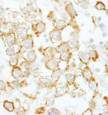 <b>Biological Strategies Validation. </b>Immunohistochemistry-Paraffin: eIF4H Antibody [NBP1-00105] - Sample: FFPE section of human testicular seminoma. Antibody: Affinity purified rabbit anti-eIF4H used at a dilution of1:200 (1ug/ml). Detection: DAB