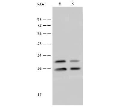 Western Blot: eIF4H Antibody [NBP2-99470] - Anti-eIF4H rabbit polyclonal antibody at 1:500 dilution. Lane A: HeLa Whole Cell Lysate Lane B: 293T Whole Cell Lysate Lysates/proteins at 30 ug per lane. Secondary Goat Anti-Rabbit IgG (H+L)/HRP at 1/10000 dilution. Developed using the ECL technique. Performed under reducing conditions. Predicted band size: 27 kDa