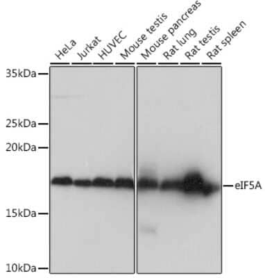 Western Blot: eIF5A Antibody (3R10I7) [NBP3-16409] - Western blot analysis of extracts of various cell lines, using eIF5A Rabbit mAb (NBP3-16409) at 1:1000 dilution. Secondary antibody: HRP Goat Anti-Rabbit IgG (H+L) at 1:10000 dilution. Lysates/proteins: 25ug per lane. Blocking buffer: 3% nonfat dry milk in TBST. Detection: ECL Basic Kit. Exposure time: 1s.