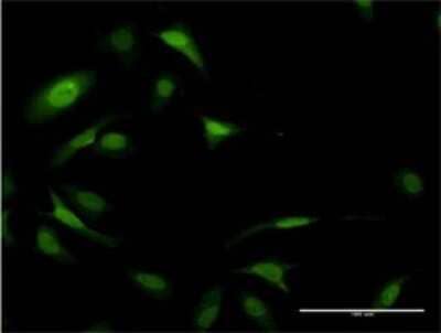 Immunocytochemistry/Immunofluorescence: eIF5A Antibody (8C1) [H00001984-M01] - Analysis of monoclonal antibody to EIF5A on HeLa cell . Antibody concentration 10 ug/ml.