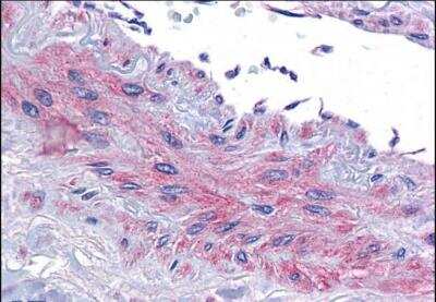 Immunohistochemistry-Paraffin: eIF5A Antibody [NBP1-51982] - Staining of paraffin embedded Human Vessel. Antibody at 3.75 ug/mL. Steamed antigen retrieval with citrate buffer pH 6, AP-staining.