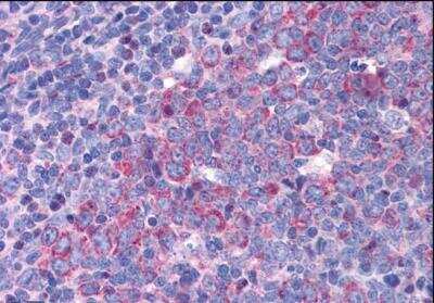 Immunohistochemistry-Paraffin: eIF5A Antibody [NBP1-51982] - Staining of paraffin embedded Human Tonsil. Antibody at 3.75 ug/mL. Steamed antigen retrieval with citrate buffer pH 6, AP-staining.