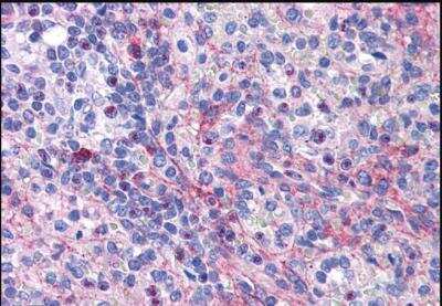 Immunohistochemistry-Paraffin: eIF5A Antibody [NBP1-51982] - Staining of paraffin embedded Human Spleen. Antibody at 3.75 ug/mL. Steamed antigen retrieval with citrate buffer pH 6, AP-staining.