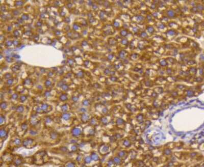 Immunohistochemistry-Paraffin: eIF5A Antibody (SC60-09) [NBP2-67591] - Analysis of paraffin-embedded mouse liver tissue using anti-eIF5A antibody. Counter stained with hematoxylin.