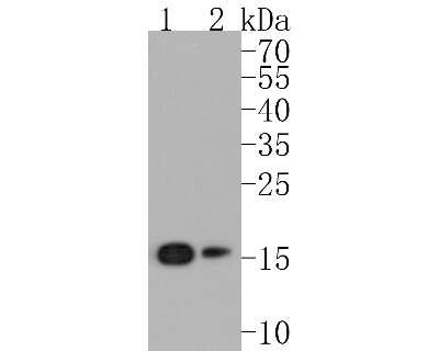 Western Blot: eIF5A Antibody (SC60-09) [NBP2-67591] - Western blot analysis of eIF5A on different lysates. Proteins were transferred to a PVDF membrane and blocked with 5% BSA in PBS for 1 hour at room temperature. The primary antibody (1/500) was used in 5% BSA at room temperature for 2 hours. Goat Anti-Rab