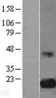 Western Blot: eIF5A Overexpression Lysate (Adult Normal) [NBL1-10214] Left-Empty vector transfected control cell lysate (HEK293 cell lysate); Right -Over-expression Lysate for eIF5A.