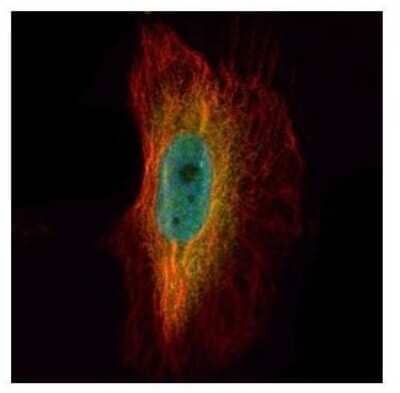 Immunocytochemistry/Immunofluorescence: eIF5A2 Antibody [NBP2-16312] - Confocal immunofluorescence analysis of paraformaldehyde-fixed HeLa, using EIF5A2 antibody (Green) at 1:500 dilution. Alpha-tubulin filaments are labeled with Alpha-tubulin antibody (Red) at 1:2000.