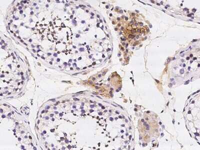 Immunohistochemistry-Paraffin: eIF5A2 Antibody [NBP2-96988] - Immunochemical staining of human eIF5A2 in human testis with rabbit polyclonal antibody at 1:10000 dilution, formalin-fixed paraffin embedded sections.