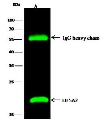 Immunoprecipitation: eIF5A2 Antibody [NBP2-96988] - eIF5A2 was immunoprecipitated using: Lane A: 0.5 mg 293T Whole Cell Lysate0.5 ul anti-eIF5A2 rabbit polyclonal antibody and 15 ul of 50 % Protein G agarose. Primary antibody: Anti-eIF5A2 rabbit polyclonal antibody, at 1:500 dilution. Secondary antibody: Dylight 800-labeled antibody to rabbit IgG (H+L), at 1:5000 dilution. Developed using the Odyssey technique. Performed under reducing conditions. Predicted band size: 15 kDa. Observed band size: 17 kDa