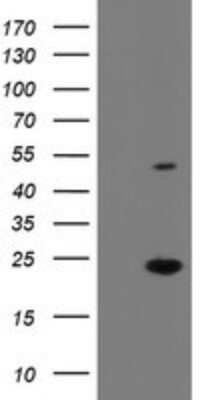 Western Blot eIF5A2 Antibody (OTI6G7)
