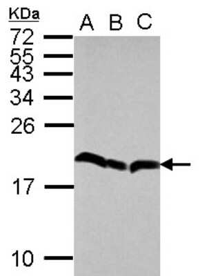 Western Blot: eIF5A2 Antibody [NBP2-16312] - Sample (30 ug of whole cell lysate) A: 293T B: A431 C: HeLa 15% SDS PAGE gel, diluted at 1:1000.