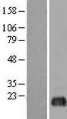 Western Blot eIF5A2 Overexpression Lysate