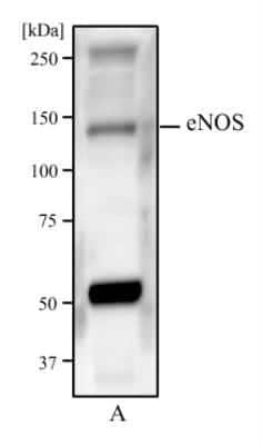 Western Blot: eNOS Antibody (6H2) - Azide and BSA Free [NBP2-80720] - Western blot analysis of HUVEC cells (A) using eNOS antibody at a concentration of 2 ug/ml. Image from the standard format of this antibody.