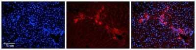 Immunohistochemistry: eRF1 Antibody [NBP1-57565] - Formalin Fixed Paraffin Embedded Tissue: Human Liver Tissue Observed Staining: Cytoplasm in bile ductule Primary Antibody Concentration: 1:100 Other Working Concentrations: 1:600 Secondary Antibody: Donkey anti-Rabbit-Cy3 Secondary Antibody Concentration: 1:200 Magnification: 20X Exposure Time: 0.5 - 2.0 sec