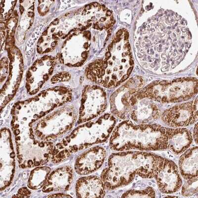 Immunohistochemistry: eRF1 Antibody [NBP2-38350] - Staining of human kidney shows strong cytoplasmic positivity in cells in tubules.