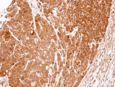 Immunohistochemistry-Paraffin: eRF1 Antibody [NBP1-31113] - Paraffin-embedded SW480 xenograft, using antibody at 1:100 dilution.