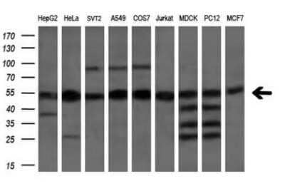 Western Blot: eRF1 Antibody (OTI2E3) - Azide and BSA Free [NBP2-70692] - Analysis of extracts (35ug) from 9 different cell lines by using anti-eRF1 monoclonal antibody (HepG2: human; HeLa: human; SVT2: mouse; A549:human; COS7: monkey; Jurkat: human; MDCK: canine; PC12: rat; MCF7: human).(1:200)