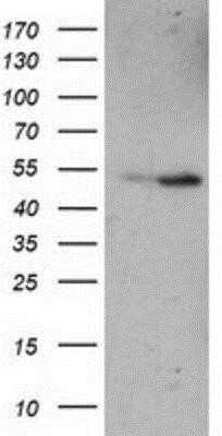 Western Blot: eRF1 Antibody (OTI2E3) - Azide and BSA Free [NBP2-70692] - HEK293T cells were transfected with the pCMV6-ENTRY control (Left lane) or pCMV6-ENTRY eRF1 (Right lane) cDNA for 48 hrs and lysed. Equivalent amounts of cell lysates (5 ug per lane) were separated by SDS-PAGE and immunoblotted with anti-eRF1.