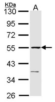 Western Blot: eRF1 Antibody [NBP1-31144] - Sample (30 ug of whole cell lysate) A: Raji 10% SDS PAGE eRF1 antibody, antibody diluted at 1:1000.