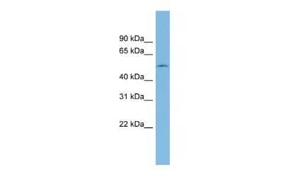 Western Blot: eRF1 Antibody [NBP1-57565] - Reccomended Titration: 0.2 - 1 ug/ml ELISA Titer: 1:62500 Positive Control: THP - 1 cell lysate