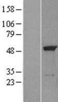 Western Blot: eRF1 Overexpression Lysate (Adult Normal) [NBL1-10348] Left-Empty vector transfected control cell lysate (HEK293 cell lysate); Right -Over-expression Lysate for eRF1.