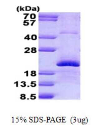 SDS-PAGE Recombinant Human Endothelin 2 His Protein