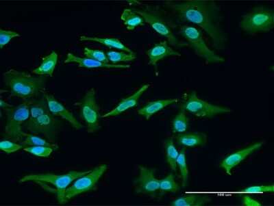 Immunocytochemistry/Immunofluorescence: engrailed homeobox 2 Antibody (1E1) [H00002020-M03] - Immunofluorescence of monoclonal antibody to engrailed homeobox 2 on HeLa cell. [antibody concentration 40 ug/ml]