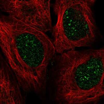 Immunocytochemistry/Immunofluorescence: engrailed homeobox 2 Antibody [NBP2-55770] - Staining of human cell line U-2 OS shows localization to nucleus & nucleoli fibrillar center.