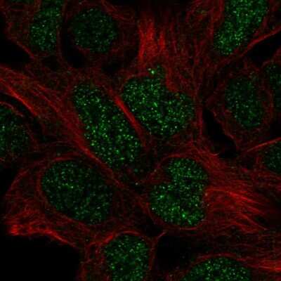 Immunocytochemistry/Immunofluorescence: engrailed homeobox 2 Antibody [NBP2-58278] - Staining of human cell line HEK 293 shows localization to nucleoplasm.