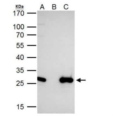 Immunoprecipitation: engrailed homeobox 2 Antibody [NBP2-14947] - HeLa whole cell lysate/extract A. 40 ug HeLa whole cell lysate/extract B. Control with 2 ug of preimmune rabbit IgG C. Immunoprecipitation of EN2 protein by 2 ug of EN2 antibody 12% SDS-PAGE The immunoprecipitated EN2 protein was detected by EN2 antibody diluted at 1:1000. EasyBlot anti-rabbit IgG was used as a secondary reagent.