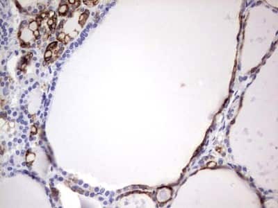 Immunohistochemistry: enkurin Antibody (6C10) [NBP2-45428] - Analysis of Human thyroid tissue. (Heat-induced epitope retrieval by 1 mM EDTA in 10mM Tris, pH8.5, 120C for 3min)