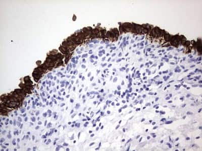 Immunohistochemistry: enkurin Antibody (6C10) [NBP2-45428] - Analysis of Human bladder tissue. (Heat-induced epitope retrieval by 1 mM EDTA in 10mM Tris, pH8.5, 120C for 3min)