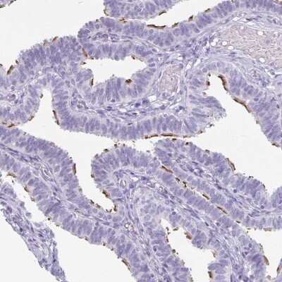 Immunohistochemistry-Paraffin: enkurin Antibody [NBP1-89911] - Staining of human fallopian tube shows high expression.