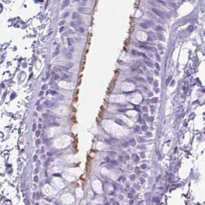 Immunohistochemistry-Paraffin: enkurin Antibody [NBP1-89911] - Staining of human bronchus.