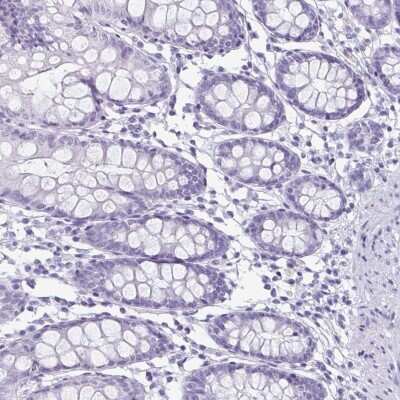 Immunohistochemistry-Paraffin: enkurin Antibody [NBP2-34037] - Staining of human colon shows low expression as expected.