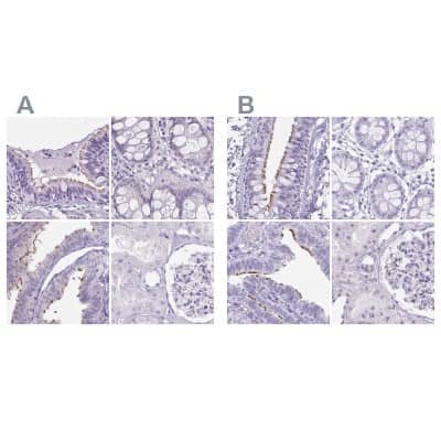 <b>Independent Antibodies Validation. </b>Immunohistochemistry-Paraffin: enkurin Antibody [NBP2-34037] - Staining of human bronchus, colon, fallopian tube and kidney using Anti-ENKUR antibody NBP2-34037 (A) shows similar protein distribution across tissues to independent antibody NBP1-89911 (B).