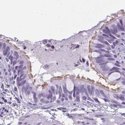 Immunohistochemistry-Paraffin: enkurin Antibody [NBP2-34037] - Staining of human bronchus.