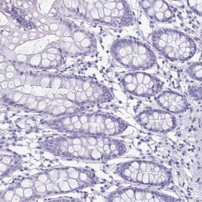 Immunohistochemistry-Paraffin: enkurin Antibody [NBP2-38925] - Staining of human colon shows low expression as expected.