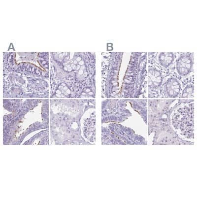 <b>Independent Antibodies Validation. </b>Immunohistochemistry-Paraffin: enkurin Antibody [NBP2-38925] - Staining of human bronchus, colon, fallopian tube and kidney using Anti-ENKUR antibody NBP2-38925 (A) shows similar protein distribution across tissues to independent antibody NBP1-89911 (B).