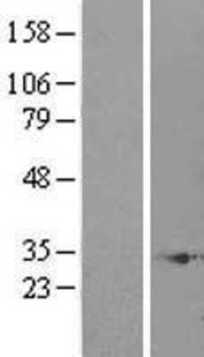 Western Blot enkurin Overexpression Lysate