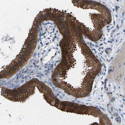 Immunohistochemistry-Paraffin: epithelial Sodium Channel alpha Antibody [NBP1-84846] - Staining of human gall bladder shows strong cytoplasmic and membranous positivity in glandular cells.