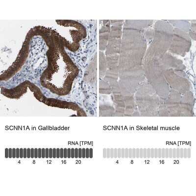 <b>Orthogonal Strategies Validation. </b>Immunohistochemistry-Paraffin: epithelial Sodium Channel alpha Antibody [NBP1-84846] - Staining in human gallbladder and skeletal muscle tissues using anti-SCNN1A antibody. Corresponding SCNN1A RNA-seq data are presented for the same tissues.