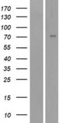 Western Blot: epithelial Sodium Channel alpha Overexpression Lysate (Adult Normal) [NBP2-10616] Left-Empty vector transfected control cell lysate (HEK293 cell lysate); Right -Over-expression Lysate for epithelial Sodium Channel alpha.