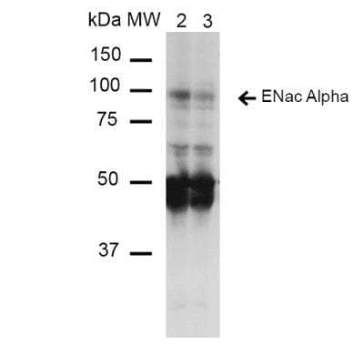 Western Blot: epithelial Sodium Channel beta Antibody (14E10) [NBP2-59383] - Analysis of Mouse Whole kidney homogenates showing detection of ~85kDa ENaC alpha protein using Mouse Anti-ENaC alpha Monoclonal Antibody, Clone 14E10.  Lane 1: Molecular Weight Ladder (MW). Lane 2: Low-salt diet. Lane 3: Normal-salt diet. Load: 20 ug. Primary Antibody: Mouse Anti-ENaC alpha Monoclonal Antibody at 1:1000. Wredicted/Observed Size: ~85kDa.