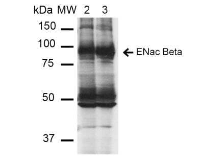 Western Blot: epithelial Sodium Channel beta Antibody (16E4) [NBP2-59381] - Analysis of Mouse Whole kidney homogenates showing detection of ~87kDa ENaC beta protein using Mouse Anti-ENaC beta Monoclonal Antibody, Clone 16E4.  Lane 1: Molecular Weight Ladder (MW). Lane 2: Low-salt diet. Lane 3: Normal-salt diet. Load: 20 ug. Primary Antibody: Mouse Anti-ENaC beta Monoclonal Antibody at 1:1000. Predicted/Observed Size: ~87kDa.