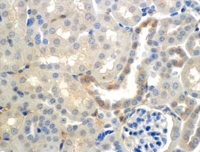 Immunohistochemistry: epithelial Sodium Channel beta Antibody (7B8) [NBP2-59380] - Immunohistochemistry analysis using Mouse Anti-epithelial Sodium Channel beta Monoclonal Antibody, Clone 7B8 (NBP2-59380). Tissue: Kidney (cortex). Species: Mouse. Primary Antibody: Mouse Anti-epithelial Sodium Channel beta Monoclonal Antibody (NBP2-59380) at 1:150. Localization: Collecting duct principal cells. Magnification: 60X.