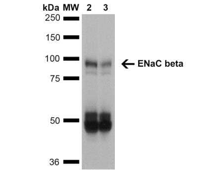 Western Blot: epithelial Sodium Channel beta Antibody (7B8) [NBP2-59380] - Analysis of Mouse Whole kidney homogenates showing detection of ~87kDa ENaC beta protein using Mouse Anti-ENaC beta Monoclonal Antibody, Clone 7B8.  Lane 1: Molecular Weight Ladder (MW). Lane 2: Low-salt diet. Lane 3: Normal-salt diet. Load: 20 ug. Primary Antibody: Mouse Anti-ENaC beta Monoclonal Antibody at 1:1000. Predicted/Observed Size: ~87kDa.