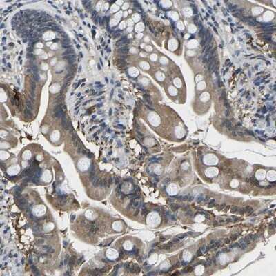 Immunohistochemistry-Paraffin: epithelial Sodium Channel beta Antibody [NBP1-84844] - Staining of human small intestine shows cytoplasmic positivity in glandular cells.